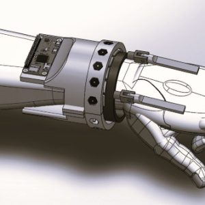 Design rendering shows the modular wearable device developed by UTC and Marmara University researchers to help reduce hand tremors.